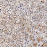 SEMA5A Antibody in Immunohistochemistry (Paraffin) (IHC (P))