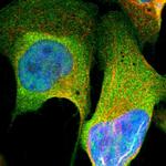 NGFR Antibody in Immunocytochemistry (ICC/IF)