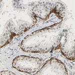 NGFR Antibody in Immunohistochemistry (Paraffin) (IHC (P))