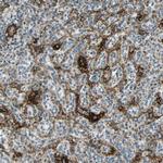 NGFR Antibody in Immunohistochemistry (Paraffin) (IHC (P))