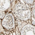 NGFR Antibody in Immunohistochemistry (Paraffin) (IHC (P))