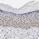 Fra2 Antibody in Immunohistochemistry (Paraffin) (IHC (P))