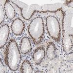 Fra2 Antibody in Immunohistochemistry (Paraffin) (IHC (P))