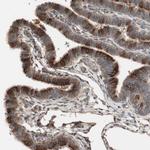 TFPI Antibody in Immunohistochemistry (Paraffin) (IHC (P))