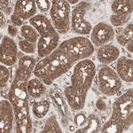 TFPI Antibody in Immunohistochemistry (Paraffin) (IHC (P))