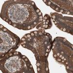 TFPI Antibody in Immunohistochemistry (Paraffin) (IHC (P))