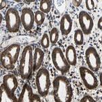 TRIM25 Antibody in Immunohistochemistry (Paraffin) (IHC (P))