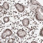 NBL1 Antibody in Immunohistochemistry (Paraffin) (IHC (P))