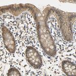 S100A6 Antibody in Immunohistochemistry (Paraffin) (IHC (P))