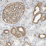 S100A6 Antibody in Immunohistochemistry (Paraffin) (IHC (P))