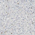 S100A6 Antibody in Immunohistochemistry (Paraffin) (IHC (P))