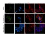 Collagen III Antibody in Immunocytochemistry (ICC/IF)