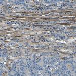 Collagen III Antibody in Immunohistochemistry (Paraffin) (IHC (P))