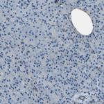 Collagen III Antibody in Immunohistochemistry (Paraffin) (IHC (P))