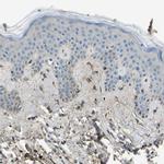 Collagen III Antibody in Immunohistochemistry (Paraffin) (IHC (P))