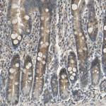 MAGI3 Antibody in Immunohistochemistry (Paraffin) (IHC (P))