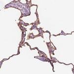 RAI3 Antibody in Immunohistochemistry (Paraffin) (IHC (P))