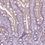 RAI3 Antibody in Immunohistochemistry (Paraffin) (IHC (P))