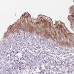 RAI3 Antibody in Immunohistochemistry (Paraffin) (IHC (P))