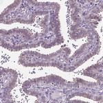 Amphiregulin Antibody in Immunohistochemistry (Paraffin) (IHC (P))