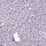 Amphiregulin Antibody in Immunohistochemistry (Paraffin) (IHC (P))