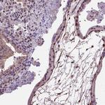 Amphiregulin Antibody in Immunohistochemistry (Paraffin) (IHC (P))