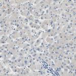 CNDP1 Antibody in Immunohistochemistry (Paraffin) (IHC (P))