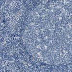 CNDP1 Antibody in Immunohistochemistry (Paraffin) (IHC (P))