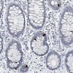 PYY Antibody in Immunohistochemistry (Paraffin) (IHC (P))