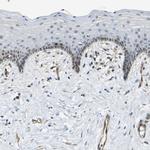 ECE1 Antibody in Immunohistochemistry (Paraffin) (IHC (P))