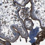 CD97 Antibody in Immunohistochemistry (Paraffin) (IHC (P))