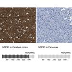 GAP43 Antibody in Immunohistochemistry (Paraffin) (IHC (P))