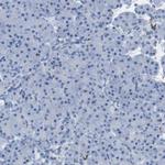 GAP43 Antibody in Immunohistochemistry (Paraffin) (IHC (P))