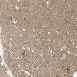 CD100 Antibody in Immunohistochemistry (Paraffin) (IHC (P))