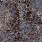 CD100 Antibody in Immunohistochemistry (Paraffin) (IHC (P))