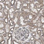 PKD2 Antibody in Immunohistochemistry (Paraffin) (IHC (P))