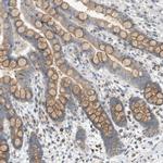 DYRK1A Antibody in Immunohistochemistry (Paraffin) (IHC (P))