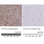 CYP11A1 Antibody in Immunohistochemistry (Paraffin) (IHC (P))