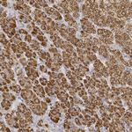 CYP11A1 Antibody in Immunohistochemistry (Paraffin) (IHC (P))