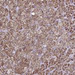 CYP11A1 Antibody in Immunohistochemistry (Paraffin) (IHC (P))