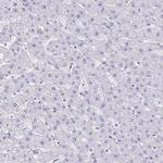 Chromogranin A Antibody in Immunohistochemistry (Paraffin) (IHC (P))