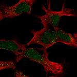 PHF14 Antibody in Immunocytochemistry (ICC/IF)