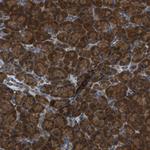 YARS Antibody in Immunohistochemistry (Paraffin) (IHC (P))