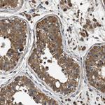 YARS Antibody in Immunohistochemistry (Paraffin) (IHC (P))