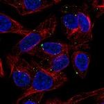 SLC39A5 Antibody in Immunocytochemistry (ICC/IF)