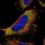 NOV Antibody in Immunocytochemistry (ICC/IF)