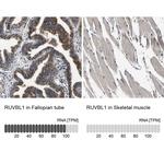 RUVBL1 Antibody in Immunohistochemistry (Paraffin) (IHC (P))