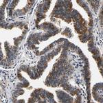 RUVBL1 Antibody in Immunohistochemistry (Paraffin) (IHC (P))