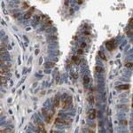 RUVBL1 Antibody in Immunohistochemistry (Paraffin) (IHC (P))