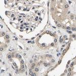 RUVBL1 Antibody in Immunohistochemistry (Paraffin) (IHC (P))